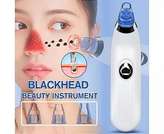 Derma Suction Blackheads Remover 3 In 1 Black Head Remover Machine-acne Pimple Pore Cleaner Vacuum Suction Tool (cell Operated) NationalBazaar